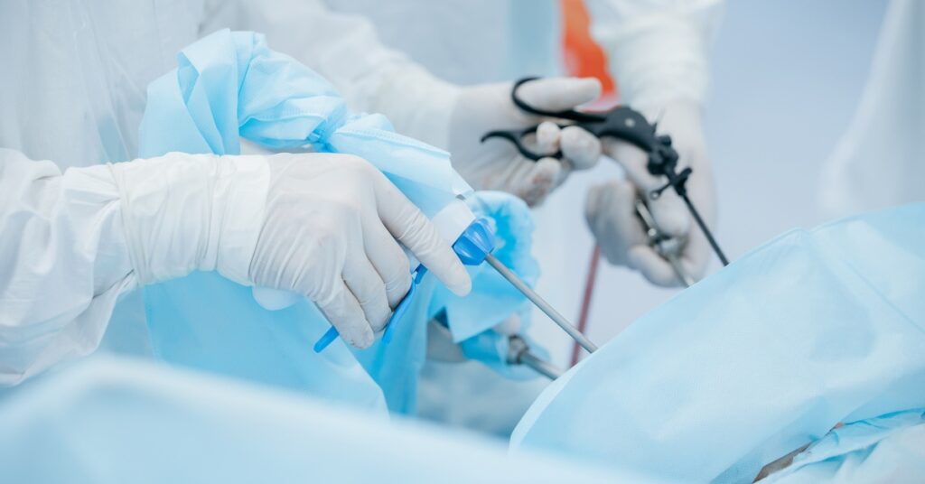 Close-up of laparoscopic devices held by surgeons. The incisions are not shown, and sterile drapes cover the patient.