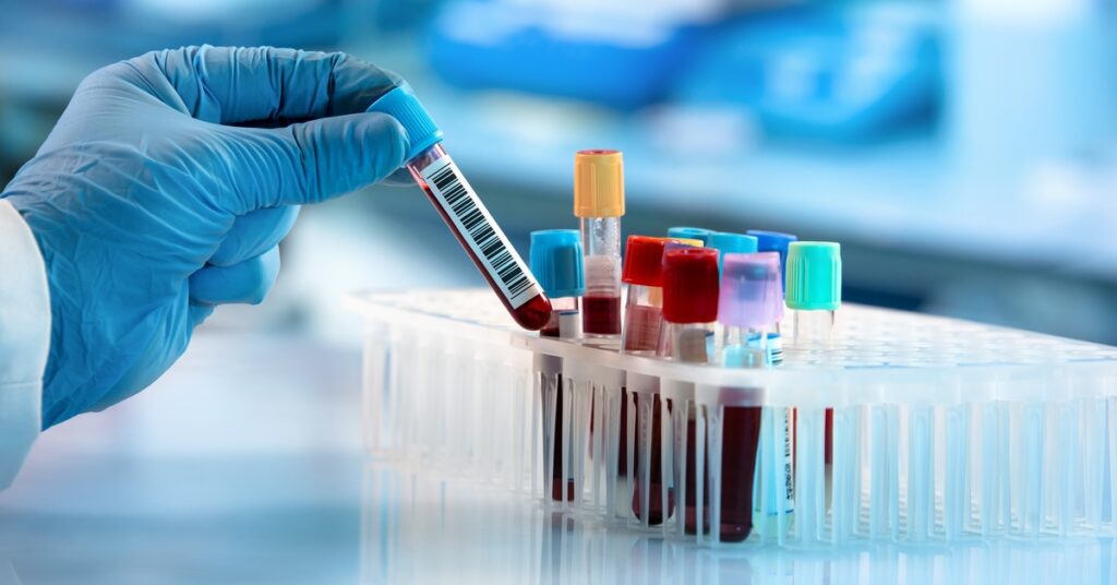 A worker in blue gloves handles a labeled test tube containing a red liquid sample. More sample tubes are in a rack.